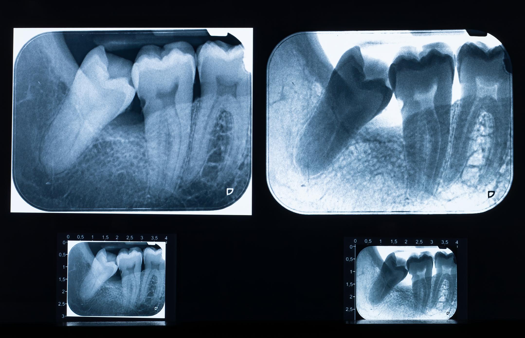 CBCT
interpretation checklist